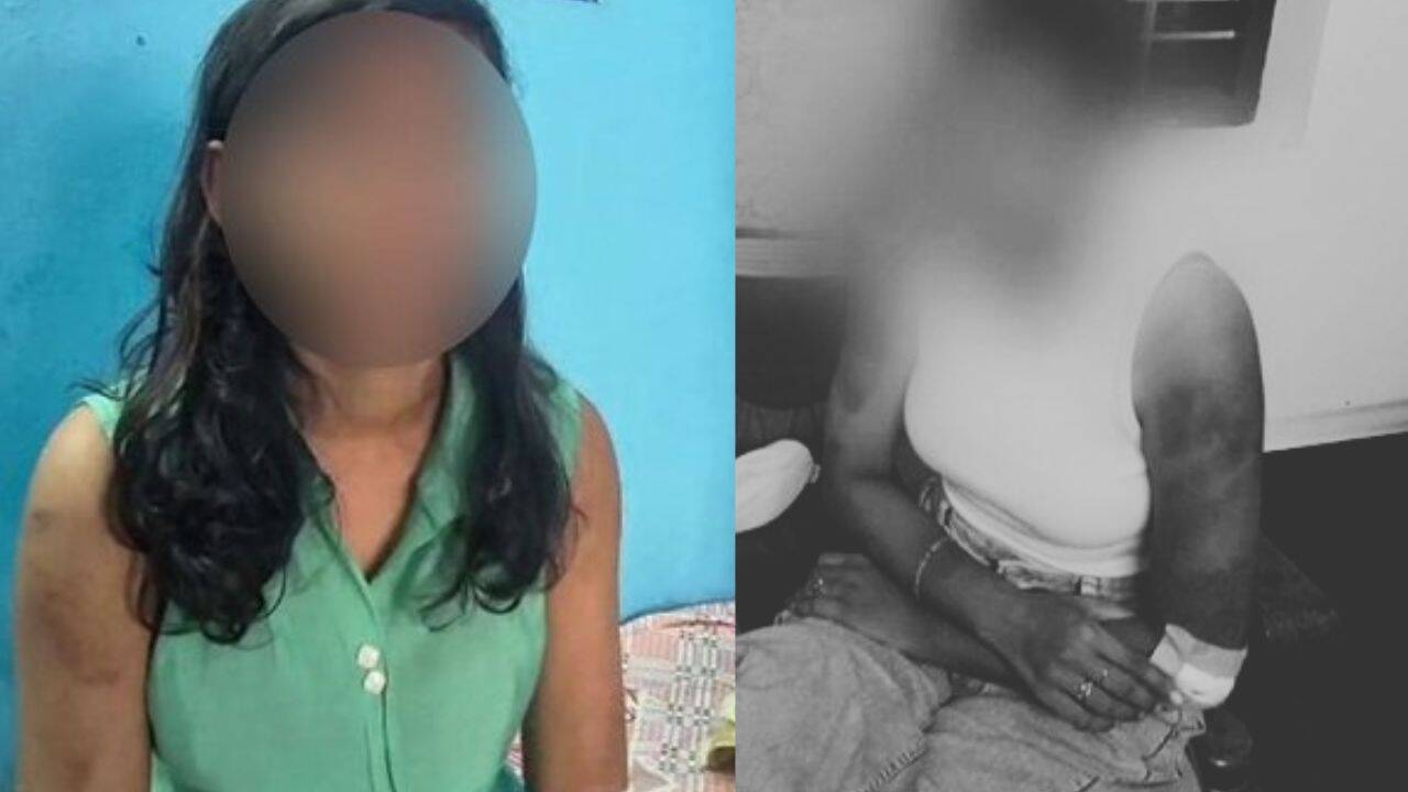 International Briefing: Assault on her private parts, hit with cooker': Woman tortured over dowry in Saudi