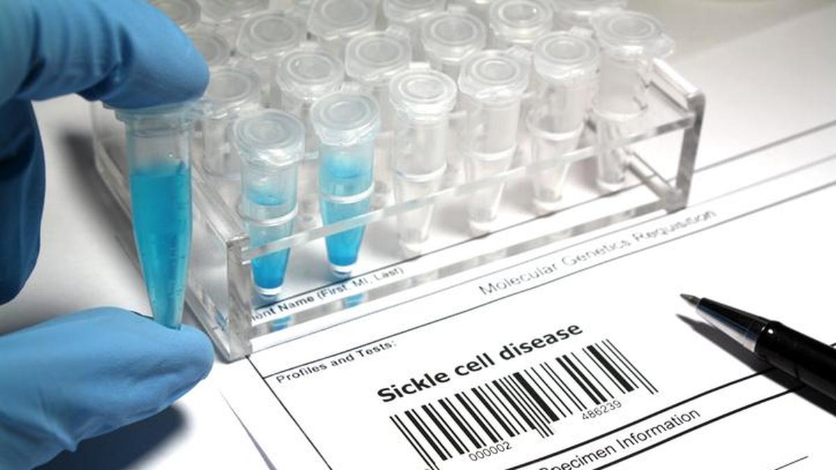 India Unveils First Sickle Cell Severity Predictor, Challenging Global Standards