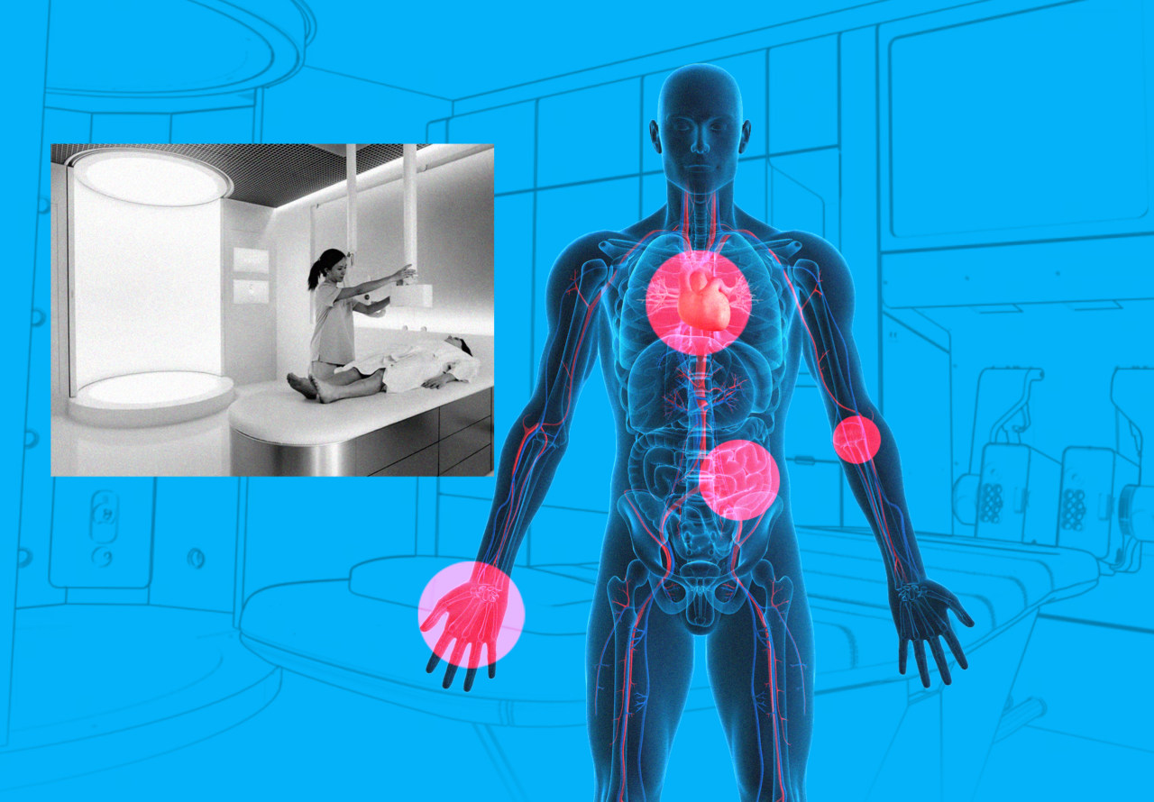 I Got a $499 Body Scan to See If I Have Cancer. Here’s What I Learned.