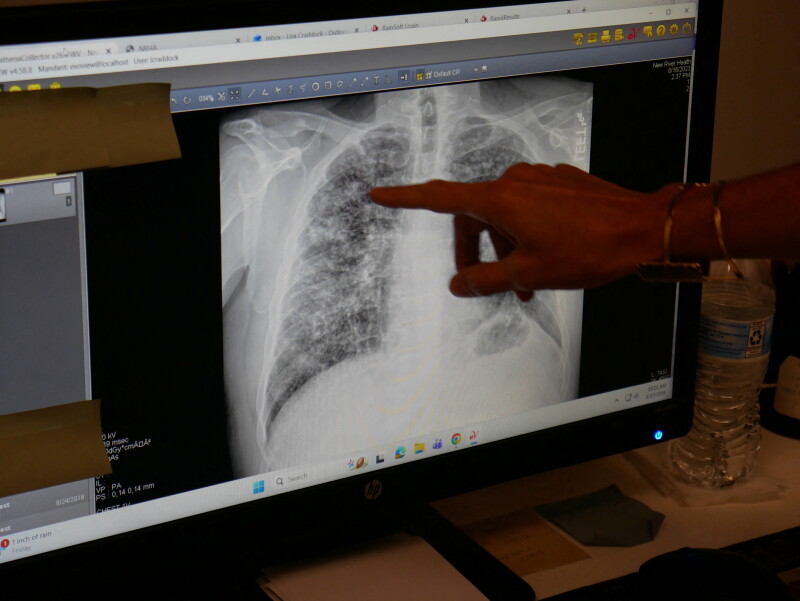 Mark Gongloff: Black Lung Disease Is the Only True Comeback for Coal