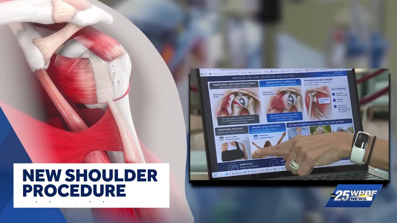 Revolutionary Shoulder Replacement Technique Leaves Patients Pain-Free and Recovery Fast
