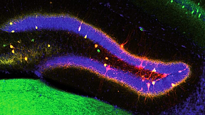 Researchers Discover How the Brain Updates Memories With New Information