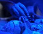 The Nurse Used the Torch on Her Phone to Do the Op’: Hospitals Stripped of Resources in Ukraine’s Occupied Territories