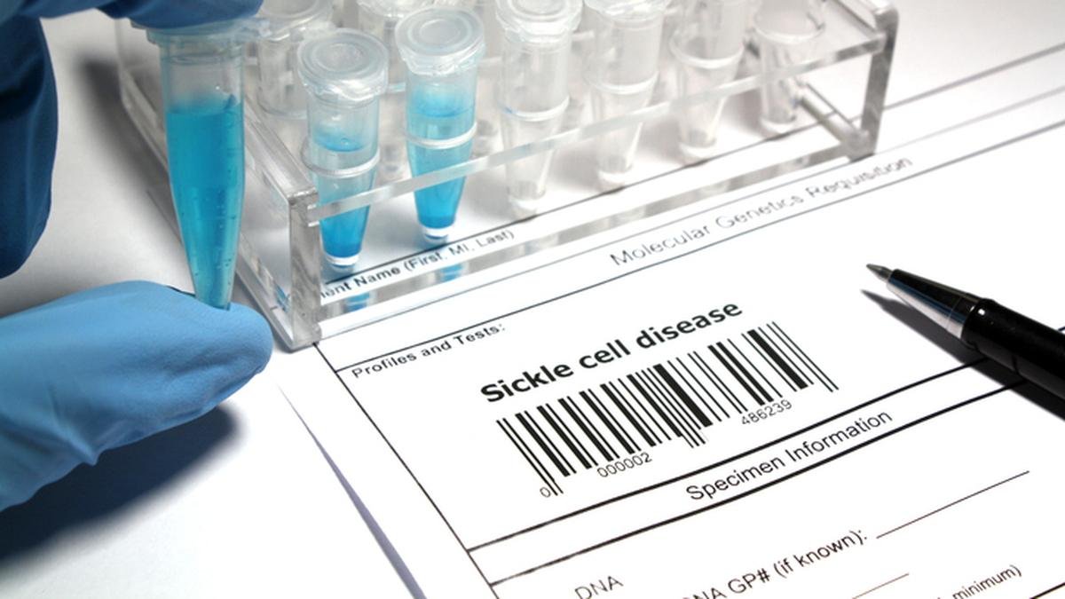 Odisha Experts Urge Sickle Cell Status Screening Before Marriage, Not Horoscopes