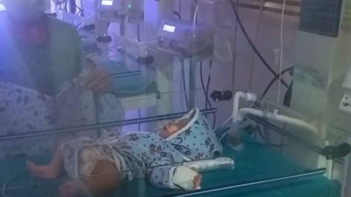 One-Day-Old Girl With Serious Heart Condition Airlifted From MP’s Ujjain To Ahmedabad