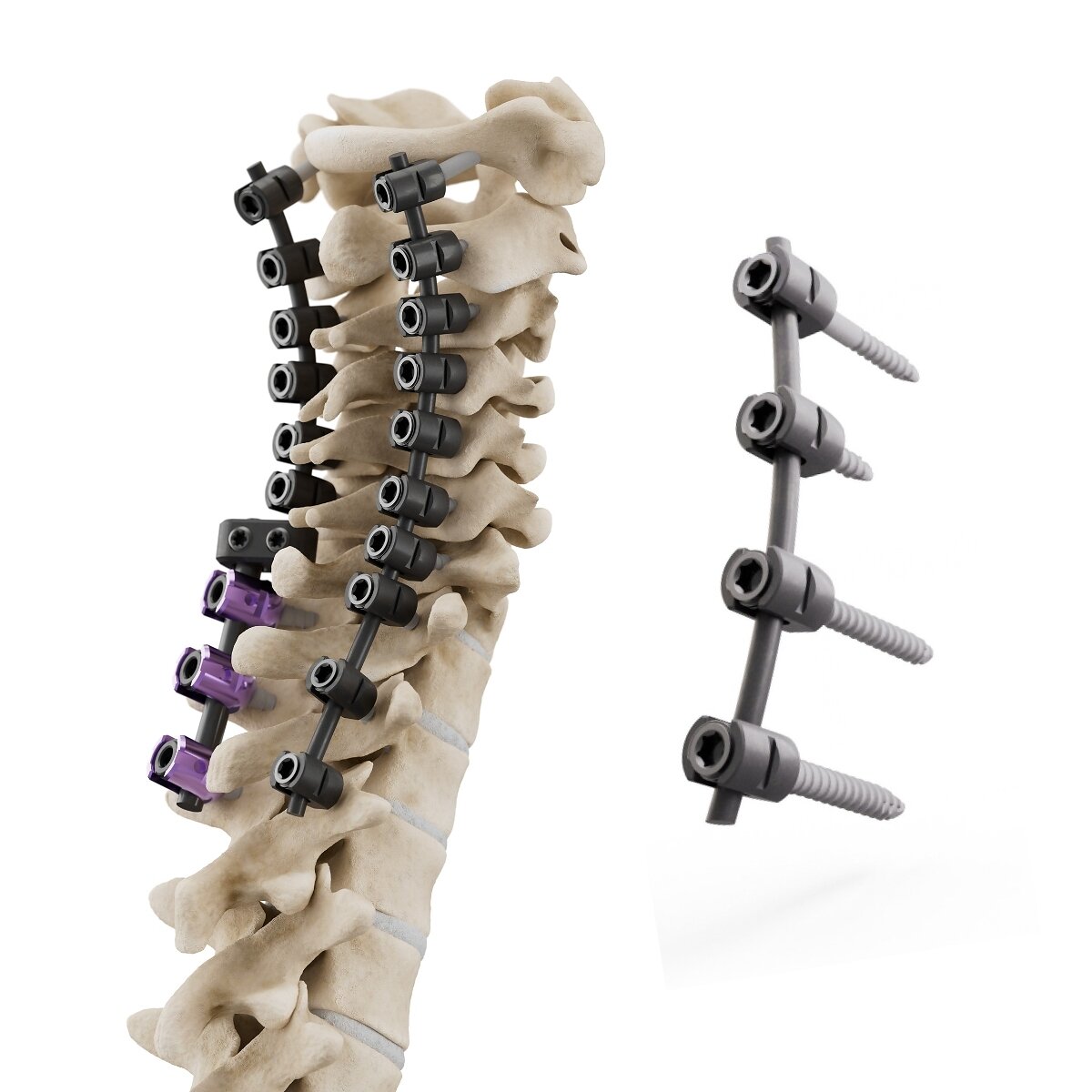 Icotec Receives CMS Approval for New Technology Add-on Payment for Its Cmore® CT System