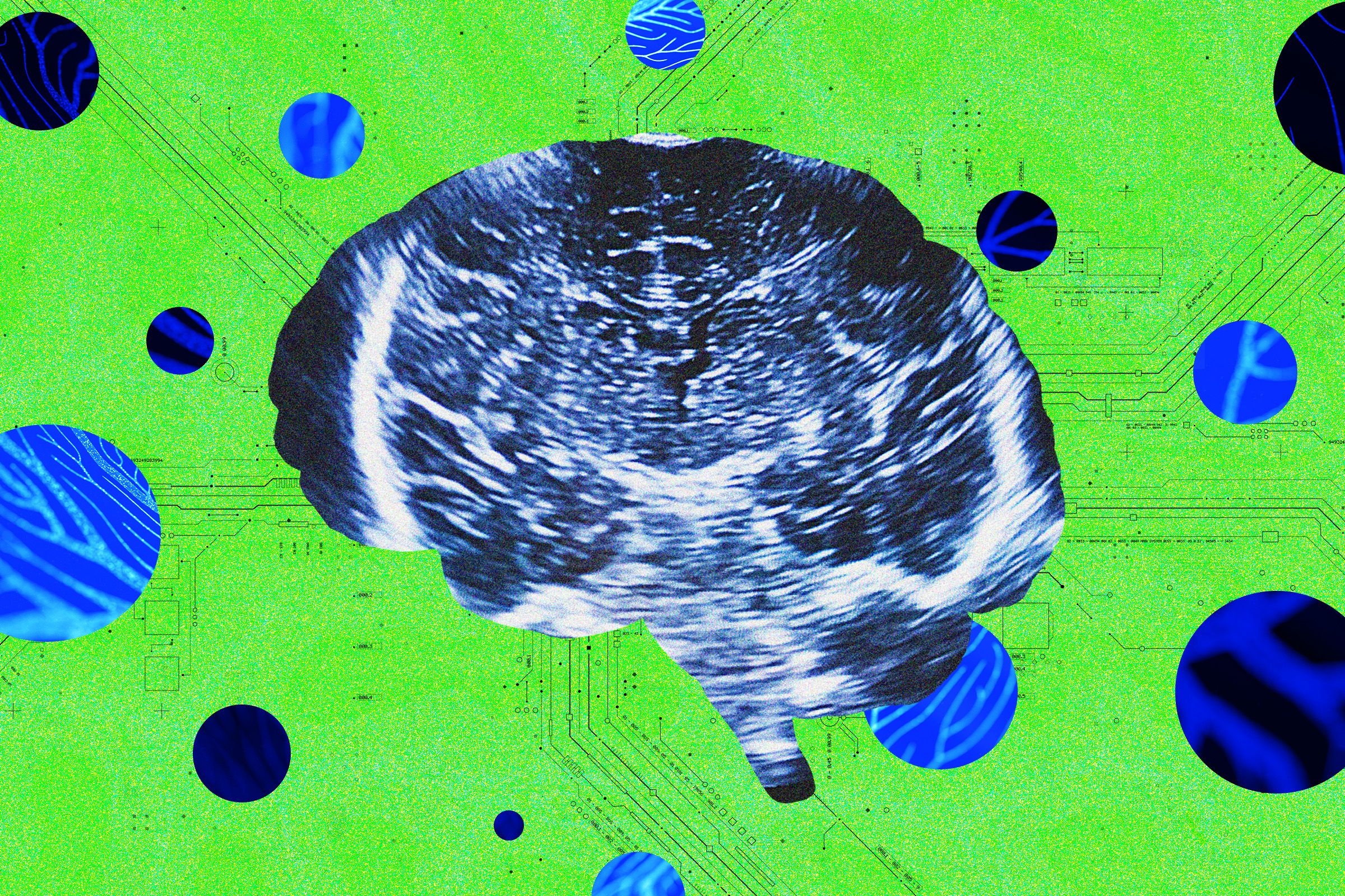A New Neurotech Startup Unveils To Rival Sam Altman’s Merge Labs in Major Strategic Push