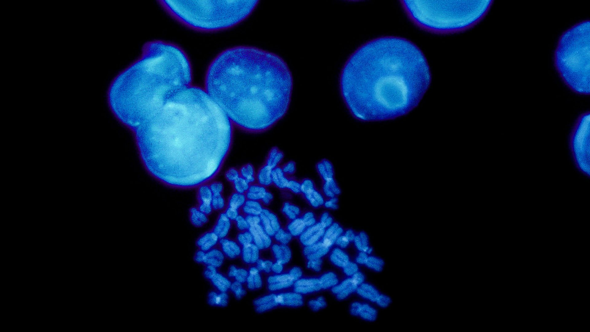 Beyond Hormones: Sex Chromosomes Rewrite the Rules of Aging and Disease