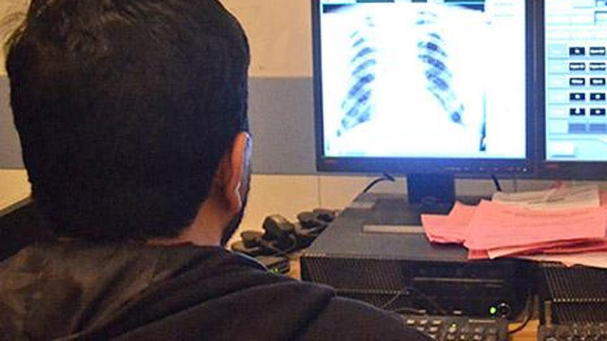 Iiit-h Study Caution Doctors Against Relying Entirely on AI for Medical Diagnosis