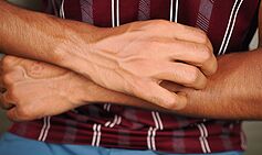 Enterprise Tech Shift: Brits with 24 skin diseases ould claim £194.60 per week from DWP and the Scaling Frontier
