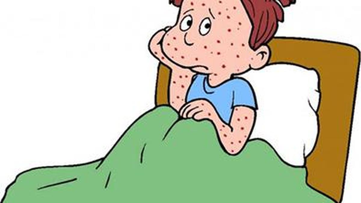 Regular Classes at Cusat School of Engineering Shift Online After Chickenpox Outbreak