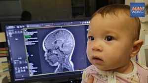$3.3m National Institutes of Health Grant Funds UH Study of Microplastics, Infant Brain Development