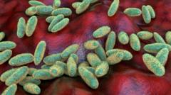 Plague Lab Worker Dies in Russia: Pneumonic Plague Fears Spark Global Alarm
