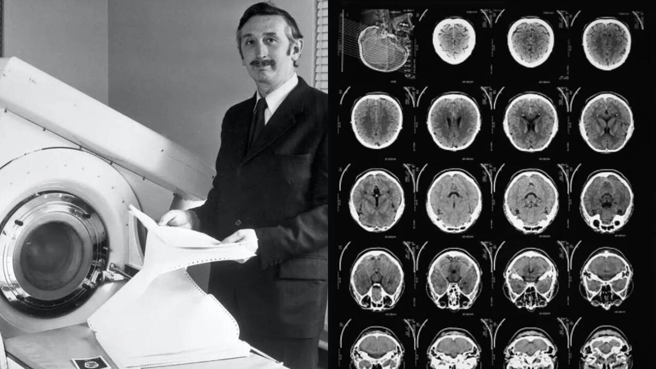 Enterprise Tech Shift: How the first CT scan detected a brain cyst and led to a Nobel Prize and the Scaling Frontier