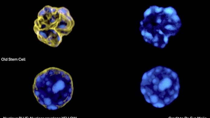 Barcelona Team Develops AI That Detects Ageing in Blood Stem Cells