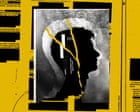 Like a Drill Going Into My Eye’: Why the Mystery Over Havana Syndrome Refuses to Die