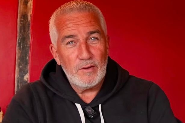 Paul Hollywood to Undergo Surgery After Suffering 'severe' Health Issue