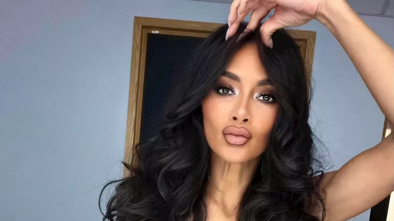 Nicole Scherzinger Overcomes Boiling Water Burns to Keep PCD Show Going