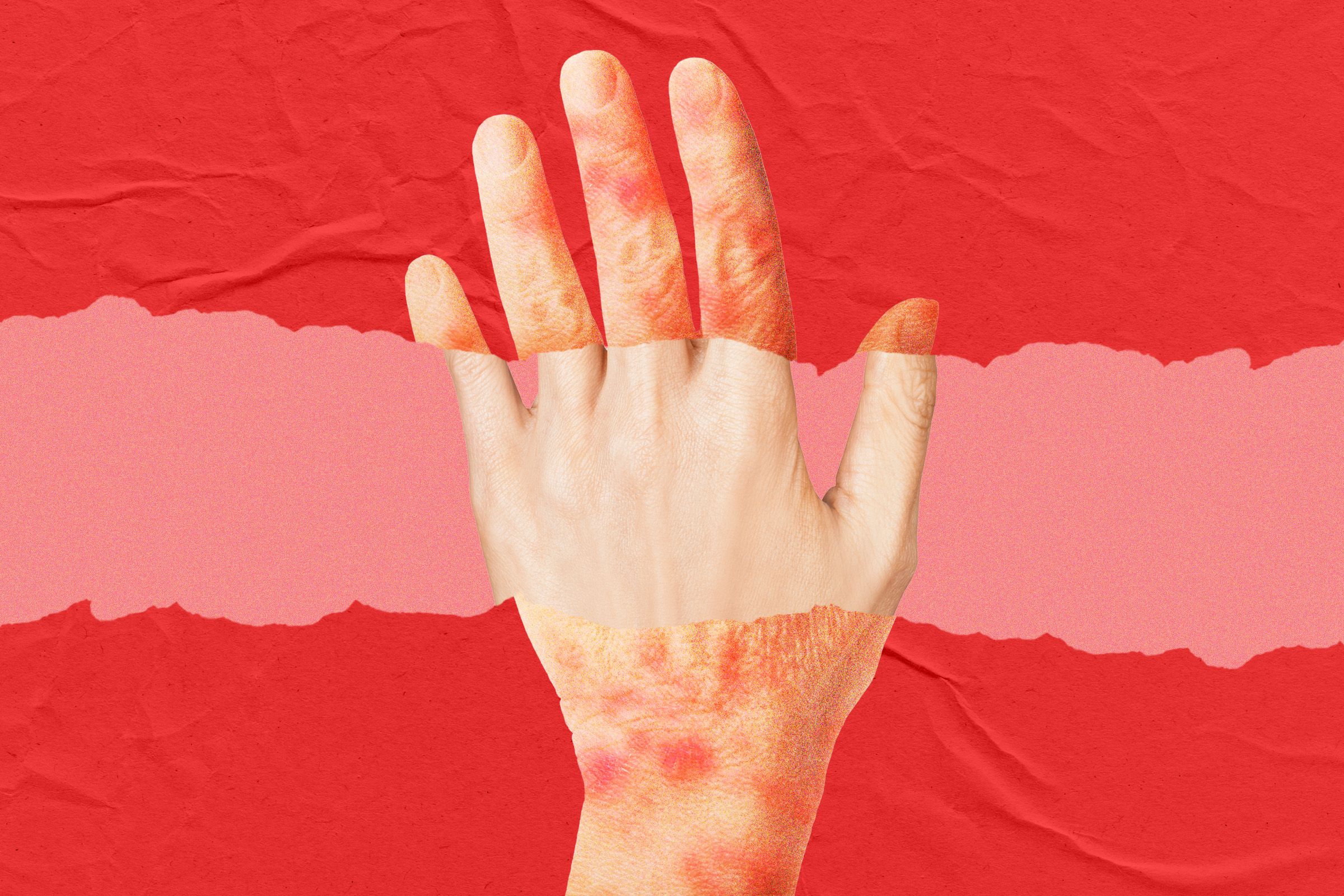 A New Anti-aging Drug Looks to Turn Back the Clock on Skin Age